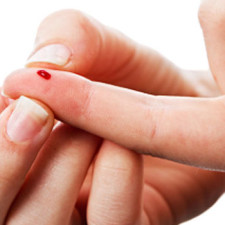 Blood Glucose testing